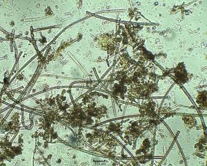 顕微鏡で確認したバクテリア